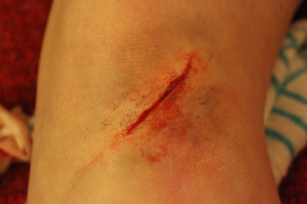 special fx sliced knee