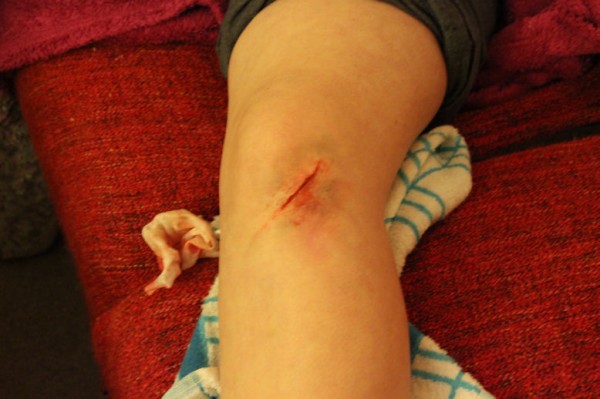 Special FX wax sliced knee